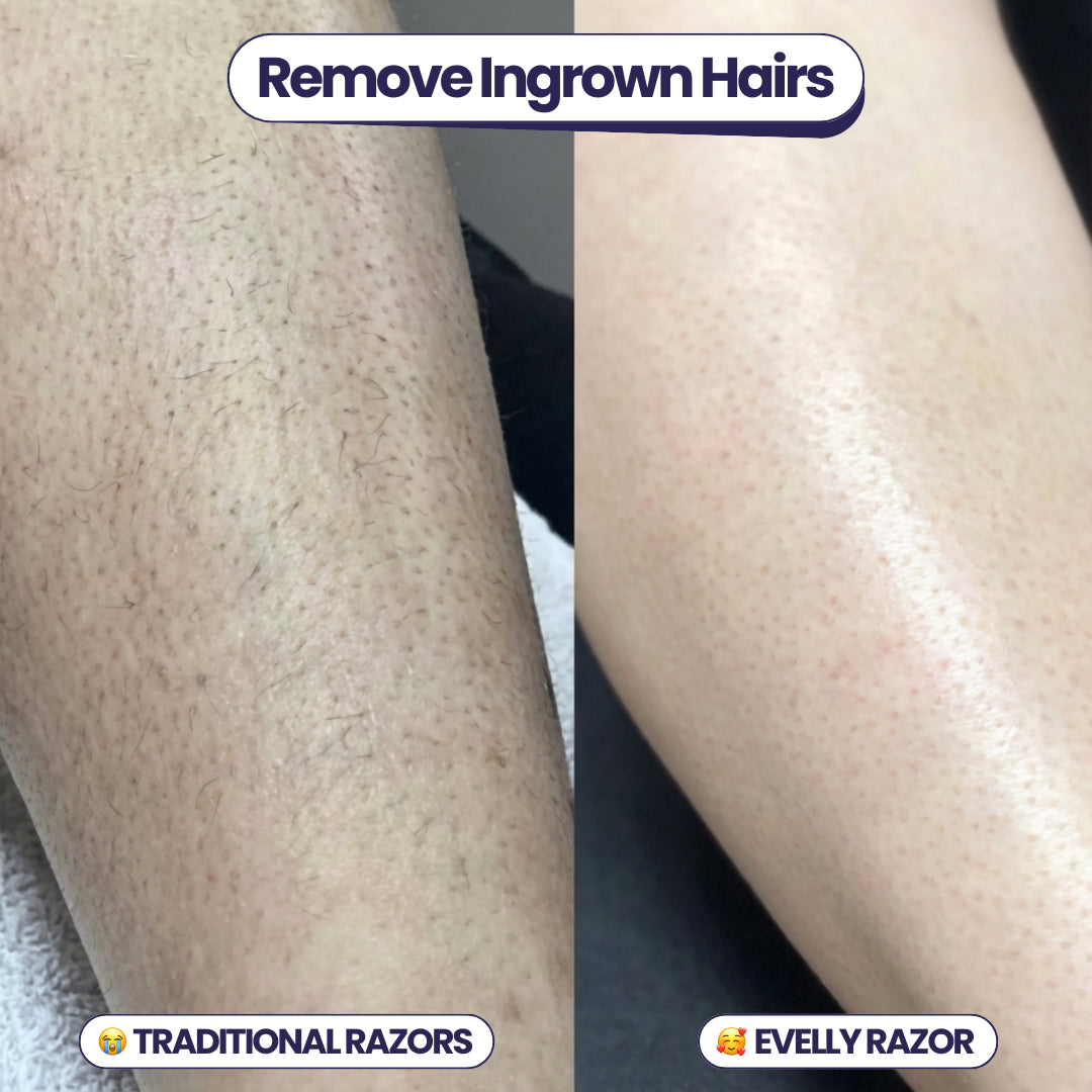 Evelly® Safety Razor