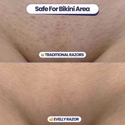 Evelly® Safety Razor